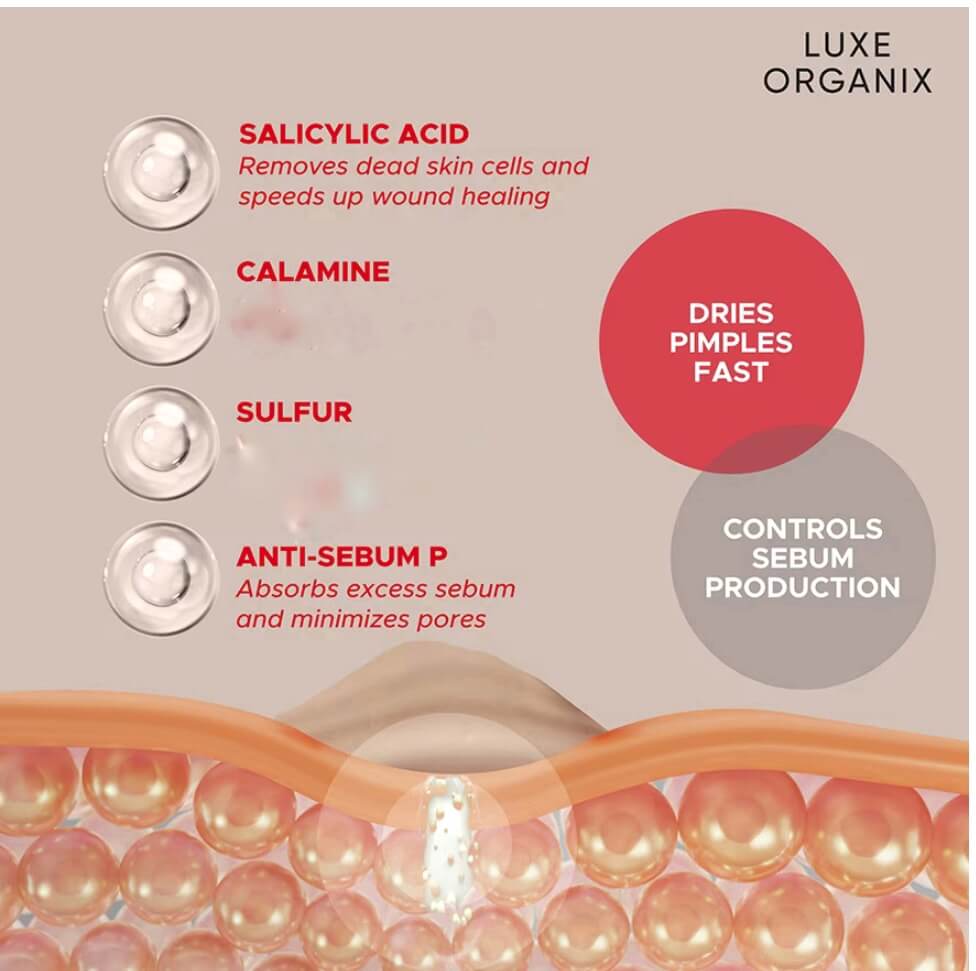 LUXE ORGANIX 2 in 1 Acne Rescue Mud Powder Overnight Treatment for fast overnight pimple drying and easy application