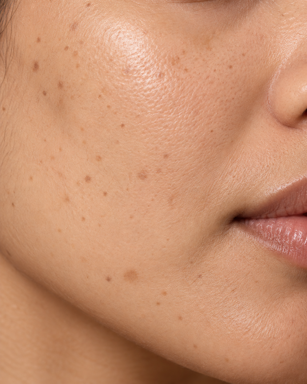 FADES THE LOOK OF DARK SPOTS