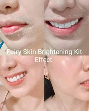 FAIRY SKIN Premium Brightening Kit Success