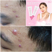 2 Packs M. Q. MQ Cosmetics Pimple & Dark Spot Eraser, 10g